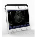 15'' Touch Screen High Resolution Portable Ultrasound Scanner Ultrasonic Diagnostic Device with Multi-frequency Probes